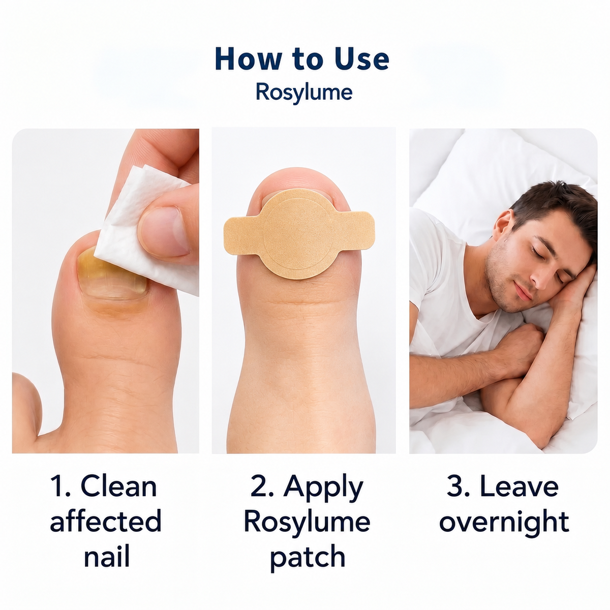 Rosylume™ Fungal Nail Patches