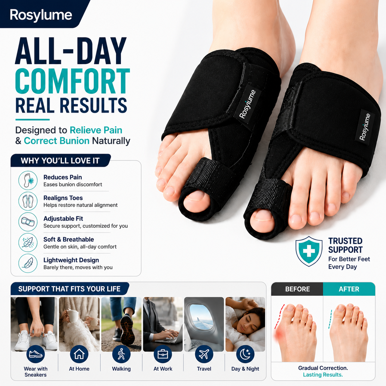 Rosylume |  linvisible Bunions Corrector🎉